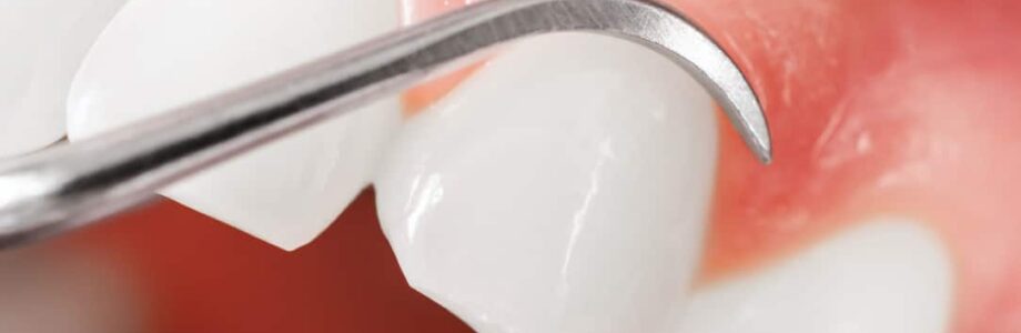 Understanding the Benefits of Linked to Periodontal Maintenance